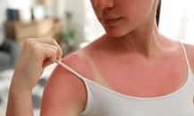 La tendance « Burn lines » est dangereuse pour la santé. © New Africa, Adobe Stock